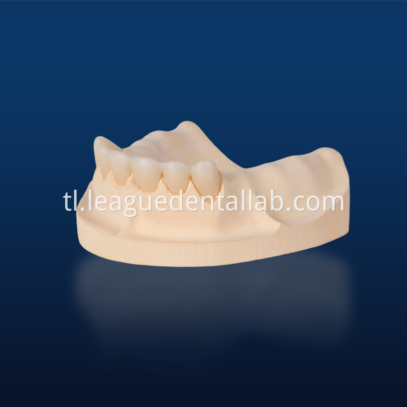 PFZ,Porcelain Fused to Zirconia,Zirconia Layered, Zirconia Veneered